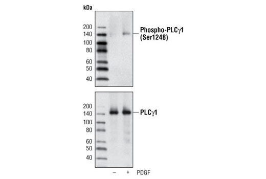 Western blot analysis of extracts from NIH/3T3 cells, untreated or PDGF-treated, using Phospho-PLCγ1 (Ser1248) Antibody (upper) or PLCγ1 Antibody #2822 (lower).