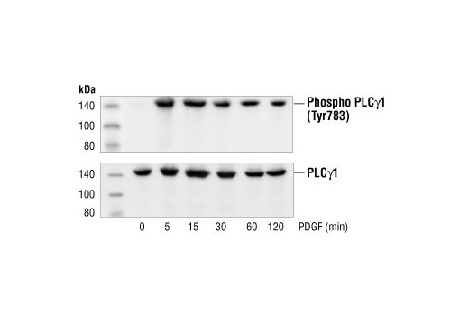Western blot analysis of extracts from NIH/3T3 cells, untreated or PDGF-stimulated for the indicated times, using Phospho-PLCγ1 (Tyr783) Antibody (upper) or PLCγ1 Antibody #2822 (lower).
