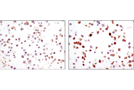 Immunohistochemical analysis of SignalSlide ® Phospho-EGF Receptor IHC Controls #8102 [paraffin-embedded KYSE450 cell pellets untreated (left) or EGF-treated (right)] using Phospho-PLCγ1 (Ser1248) (D25A9) Rabbit mAb.