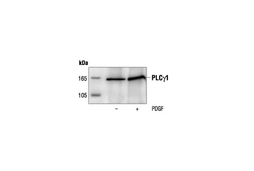 Immunoprecipitation of PLCγ1 from untreated or PDGF treated NIH/3T3 cells followed by Western blot analysis, using PLCγ1 Antibody.