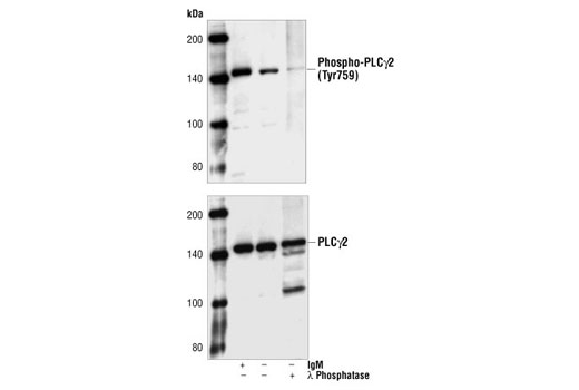 Western blot analysis of extracts from untreated or anti-human IgM treated Ramos cells or lamda phosphatase-treated Ramos cell lysates, using Phospho-PLCgamma2 (Tyr759) Antibody (upper) or PLCgamma2 Antibody #3872 (lower).