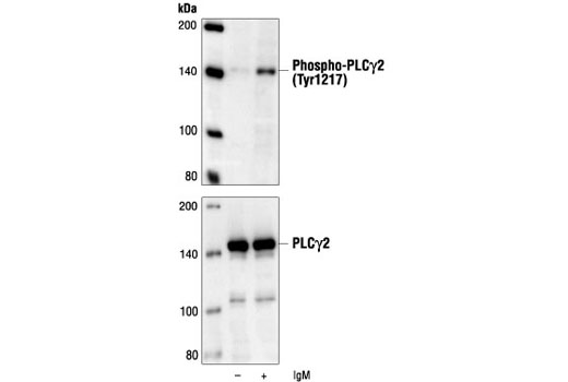 Western blot analysis of extracts from Ramos cells, untreated or treated with anti-human IgM, using Phospho-PLCgamma2 (Tyr1217) Antibody (upper) or PLCgamma2 Antibody #3872 (lower).