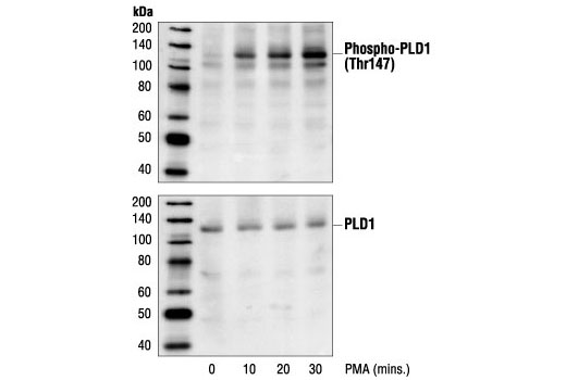 Western blot analysis of extracts from HeLa cells, untreated or PMA-treated for the indicated times, using Phospho-PLD1 (Thr147) Antibody (upper) or PLD1 Antibody #3832 (lower).