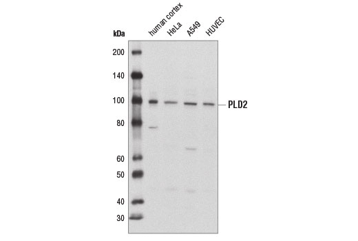 Western blot analysis of extracts from various tissues and cell lines using PLD2 (E1Y9G) Rabbit mAb.