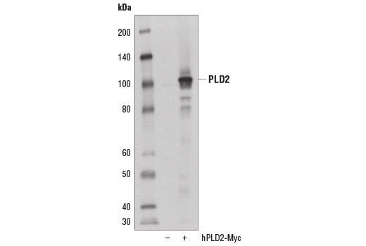 Western blot analysis of extracts from 293T cells, mock transfected (-) or transfected with a construct expressing Myc-tagged full-length human PLD2 protein (hPLD2-Myc; +), using PLD2 (E1Y9G) Rabbit mAb.