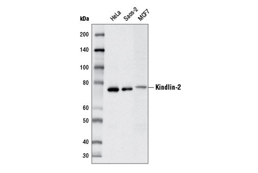 Western blot analysis of extracts from HeLa, Saos-2, and MCF7 cells using Kindlin-2 Antibody.
