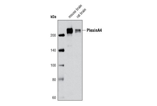 Western blot analysis of extracts from mouse brain and rat brain using Plexin A4 (C5D1) Rabbit mAb.