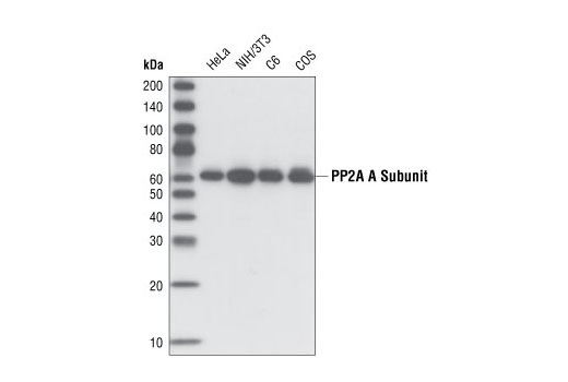 Western blot analysis of extracts from various cell lines using PP2A A Subunit (81G5) Rabbit mAb.