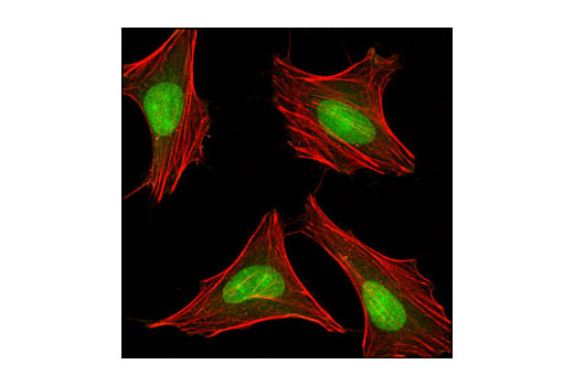 Confocal immunofluorescent analysis of HeLa cells using PP2A A Subunit (81G5) Rabbit mAb (green). Actin filaments have been labeled with Alexa Fluor® 555 phalloidin (red).