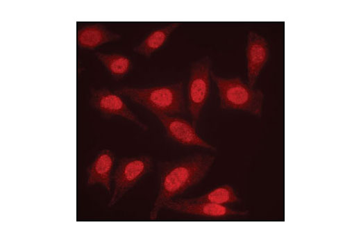 Immunoflourescent staining of paraformaldehyde fixed HeLa cells, using PP2A A Subunit Antibody.
