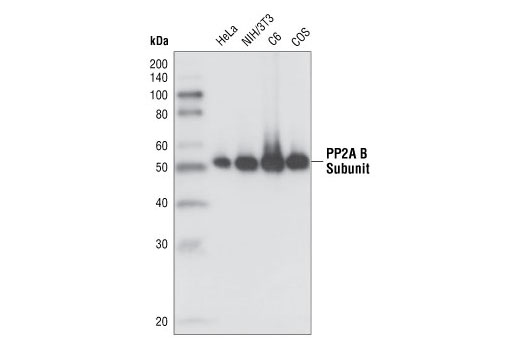 Western blot analysis of cell lysates from HeLa, NIH/3T3, C6 and COS cells, using PP2A B Subunit (100C1) Rabbit mAb.