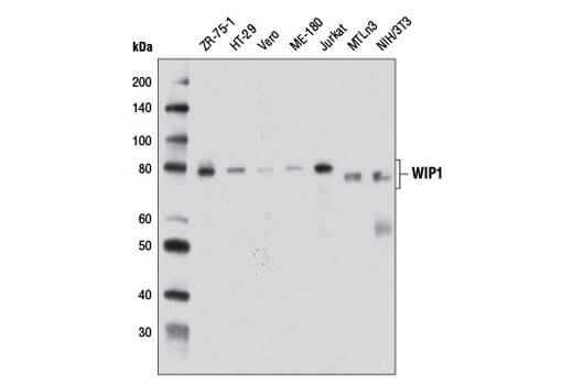 Western blot analysis of extracts from various cell lines using WIP1 (D4F7) Rabbit mAb.