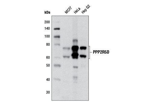 Western blot analysis of extracts from MCF7, HeLa, and Hep G2 cells using PPP2R5D (H5D12) Mouse mAb.