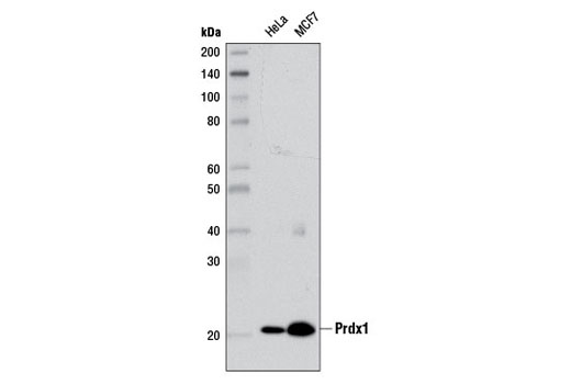 Western blot analysis of extracts from HeLa and MCF7 cells using Prdx1 (D5G12) Rabbit mAb.