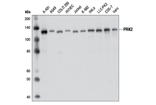 Western blot analysis of extracts from various cell lines using PRK2 (D10A10) Rabbit mAb.