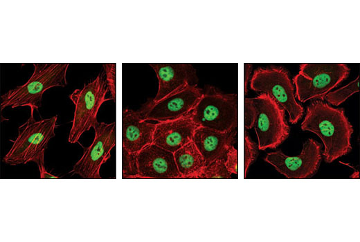 Confocal immunofluorescent analysis of either untreated HeLa (left), HCT-116 (middle) or SK-OV-3 (right) cells using PRMT1 (A33) Antibody (green). Actin filaments have been labeled with Alexa Fluor ® 555 phalloidin (red).