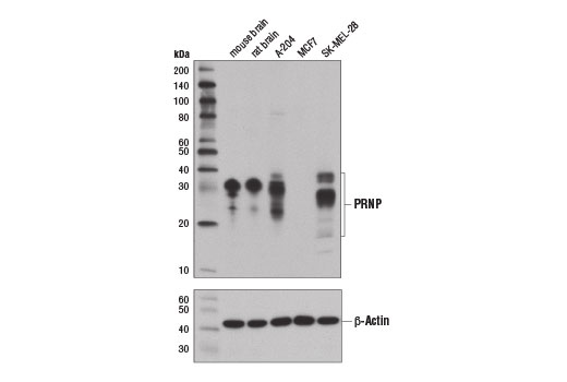 Western blot analysis of extracts from various tissues and cell lines using PRNP (D3Q5C) Rabbit mAb (upper) and β-Actin (D6A8) Rabbit mAb #8457 (lower).
