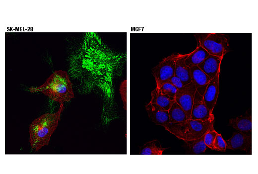 Confocal immunofluorescent analysis of SK-MEL-28 (positive, left) or MCF7 (negative, right) cells, using PRNP (D3Q5C) Rabbit mAb (green). Actin filaments were labeled with DyLight™ 554 Phalloidin #13054 (red). Blue pseudocolor = DRAQ5 ® #4084 (fluorescent DNA dye).