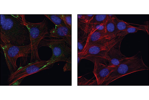 Confocal immunofluorescent images of C2C12 cells labeled wtih Profilin-1 Antibody (green, left) compared to an isotype control (right). Actin filaments have been labeled with Alexa Fluor® 555 phalloidin (red). Blue pseudocolor = DRAQ5™ (fluorescent DNA dye).