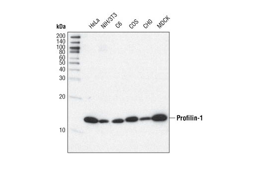 Western blot analysis of extracts from various cell types using Profilin-1 (C56B8) Rabbit mAb.