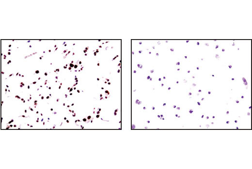 Immunohistochemical analysis of paraffin-embedded T47D cells (positive, left) and MDA-MB-231 cells (negative, right) using Progesterone Receptor A/B (C89F1) Rabbit mAb.
