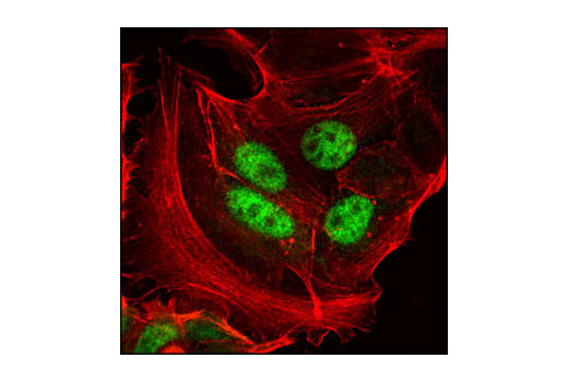 Confocal immunofluorescent analysis of MCF-7 cells using Progesterone Receptor B Receptor (C1A2) Rabbit mAb (green). Actin filaments have been labeled with DY-554 phalloidin (red).