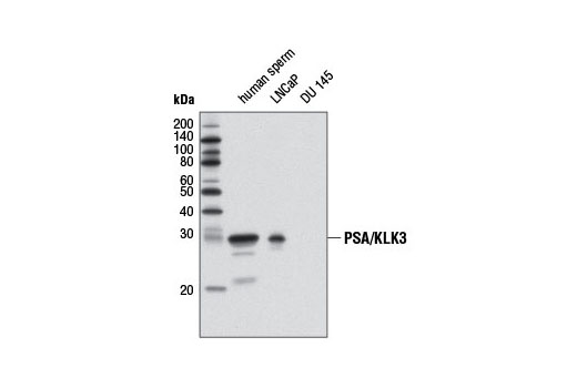 Western blot analysis of extracts from human sperm and LNCaP and DU 145 cells using PSA/KLK3 (D11E1) XP ® Rabbit mAb. DU 145 cells are negative as expected.