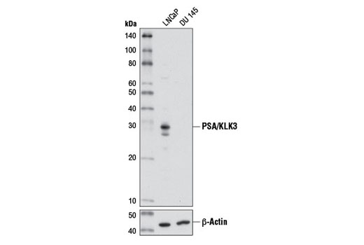Western blot analysis of extracts from LNCaP (PSA positive) and DU 145 (PSA negative) cells using PSA/KLK3 (D2A8) Rabbit mAb (upper) or β-Actin (D6A8) Rabbit mAb #8457 (lower).