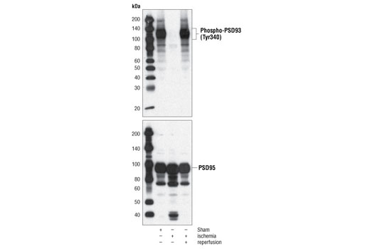 Western blot analysis of extracts from rat brain, either sham-operated, 15 min ischemia followed by 4 h reperfusion, or 15 min ischemia only, using Phospho-PSD93 (Tyr340) Antibody (upper) or PSD95 Antibody (lower).