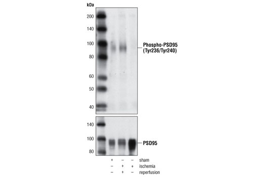 Western blot analysis of extracts from rat brain, either sham operated or subjected to ischemia (15 min) alone or followed by reperfusion (4 hours), using Phospho-PSD95 (Tyr236/Tyr240) Antibody (upper) and PSD95 Antibody #2507 (lower).