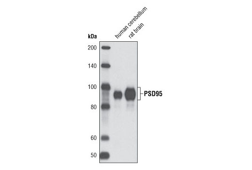 Western blot analysis of extracts from human cerebellum and rat brain using PSD95 (D27E11) XP ® Rabbit mAb.