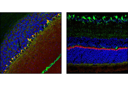 Confocal immunofluorescent analysis of rat cerebellum and retina using PSD95 (D27E11) XP ® Rabbit mAb (red) and Neurofilament-L (DA2) Mouse mAb #2835 (green). Blue pseudocolor = DRAQ5 ® #4084 (fluorescent DNA dye).