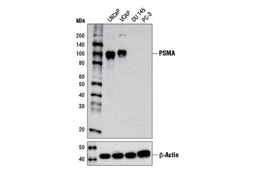 Western blot analysis of extracts from various cell lines using Prostate Specific Membrane Antigen (D4S1F) Rabbit mAb (upper) or β-Actin (D6A8) Rabbit mAb #8457 (lower)