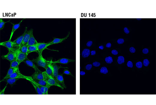 Confocal immunofluorescent analysis of LNCaP (positive, left) and DU 145 (negative, right) cells using PSMA (D4S1F) Rabbit mAb (green). Blue pseudocolor = DRAQ5 ® #4084 (fluorescent DNA dye).