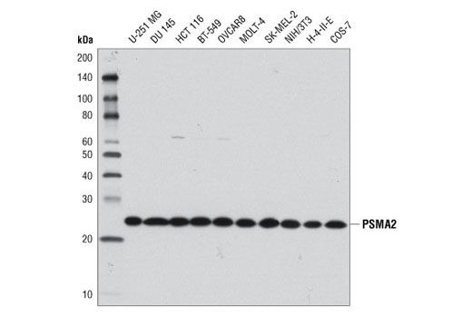 Western blot analysis of extracts from various cell lines using PSMA2 (D3A4) Rabbit mAb.