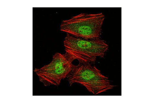 Confocal immunofluorescent analysis of HeLa cells using PSMA2 Antibody (green). Actin filaments have been labeled with Alexa Fluor ® 555 phalloidin (red).