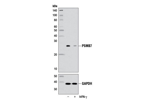 Western blot analysis of extracts from HeLa cells, untreated (-) or treated with Human Interferon-γ (hIFN-γ) #8901 (100 ng/ml, 72 hr; +), using PSMB7 (E1L5H) Rabbit mAb (upper) and GAPDH (D16H11) XP ® Rabbit mAb #5174 (lower).