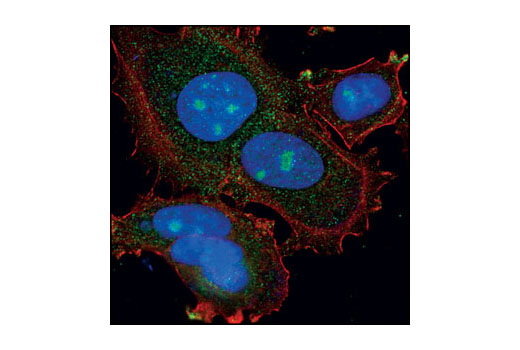 Confocal immunofluorescent analysis of MCF-7 cells labeled with PA28β Antibody (green). Actin filaments have been labeled with Alexa Fluor® 555 phalloidin (red).