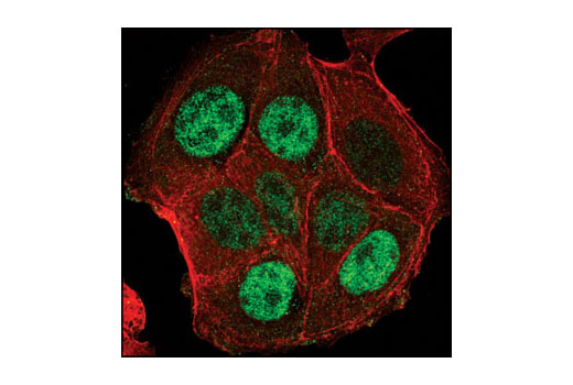 Confocal immunofluorescent analysis of MCF-7 cells using PA28γ Antibody (green). Actin filaments have been labeled with Alexa Fluor® 555 phalloidin (red).