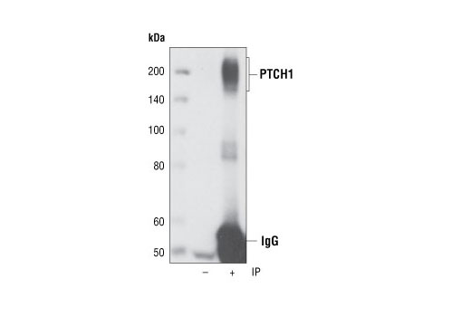 Immunoprecipitation of endogenous PTCH1 from 293 cell lysates using PTCH1 (C53A3) Rabbit mAb. Western blot detection was performed using the same antibody.