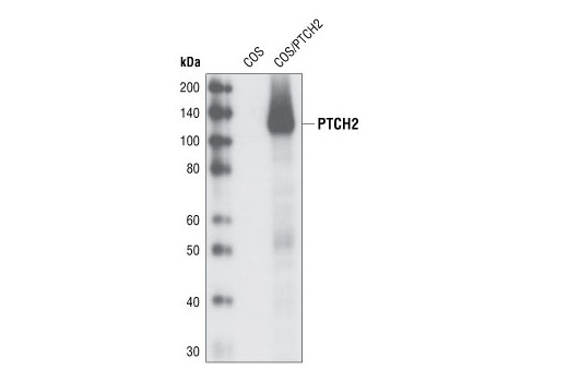 Western blot analysis of extracts from COS cells, untransfected or transiently transfected with a construct expressing human PTCH2, using PTCH2 (G1191) Antibody.