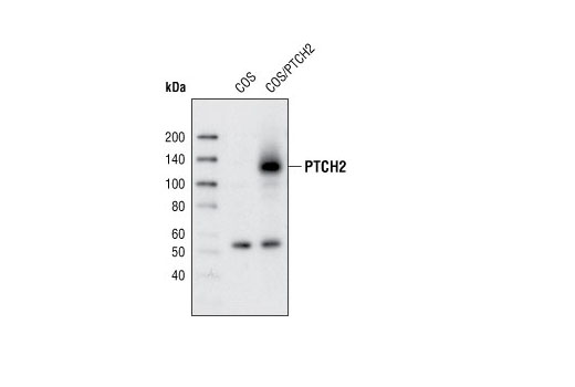 Western blot analysis of total cell lysates from COS cells and COS cells transiently transfected with a construct expressing human PTCH2 using PTCH2 (L849) Antibody.