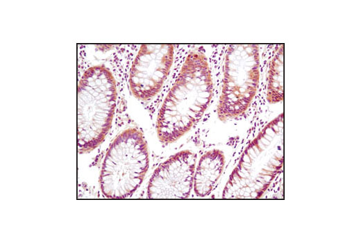Immunohistochemical analysis of paraffin-embedded human colon using PTEN (D4.3) XP ® Rabbit mAb.