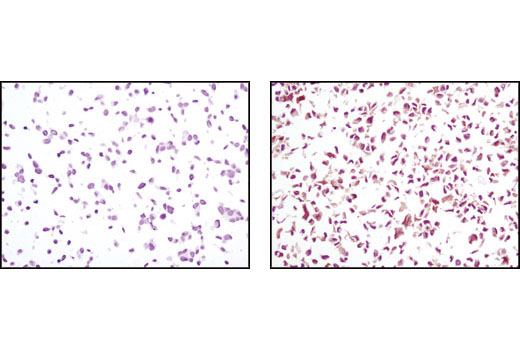 Immunohistochemical analysis using PTEN (D4.3) XP ® Rabbit mAb on SignalSlide(TM) PTEN IHC Controls #8106 (paraffin-embedded LNCaP (left) and NIH/3T3 (right) cells).