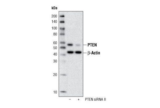 Western blot analysis of extracts from HeLa cells, transfected with 100 nM SignalSilence ® Control siRNA (Fluorescein Conjugate) #6201 (-) or SignalSilence ® PTEN siRNA II (+), using PTEN (138G6) Rabbit mAb and β-Actin (13E5) Rabbit mAb #4970. PTEN (138G6) Rabbit mAb confirms silencing of PTEN expression, while the β-Actin (13E5) Rabbit mAb is used to control for loading and specificity of PTEN siRNA.