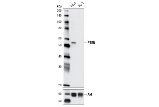 Western blot analysis of extracts from HeLa and PC-3 cells using PTEN (D5G7) Rabbit mAb (upper) and Akt (pan) (C67E7) Rabbit mAb #4691 (lower).