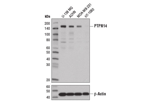 Western blot analysis of extracts from various cell lines using PTPN14 (D5T6Y) Rabbit mAb (upper) and β-Actin (D6A8) Rabbit mAb #8457 (lower).