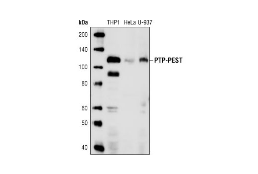 Western blot analysis of extracts from THP1, HeLa and U-937 cells using PEP-PEST (AG10) Mouse mAb.