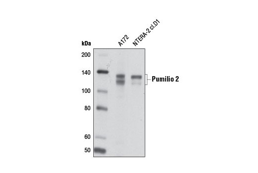 Western blot analysis of extracts from A172 and NTERA-2 cl.D1 cells using Pumilio 2 Antibody.