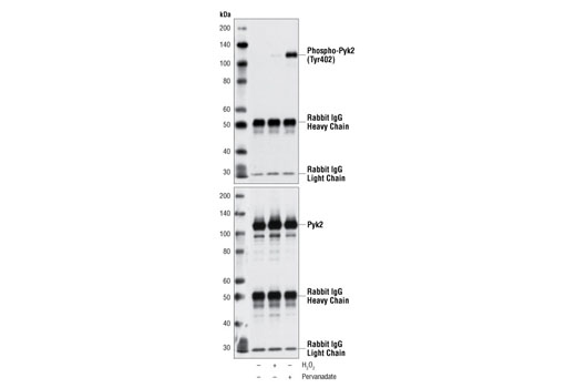 Immunoprecipitation of Pyk2 from Ramos cells, untreated, H 2 O 2 -treated, or Pervanadate-treated, using Pyk2 Antibody #3292, followed by Western blot with Phospho-Pyk2 (Tyr402) Antibody (upper), or Pyk2 Antibody #3292 (lower).